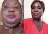 Massive Transformation! Lepacious Bose Share Shocking Before And After Photo Of Her Neck Transformation