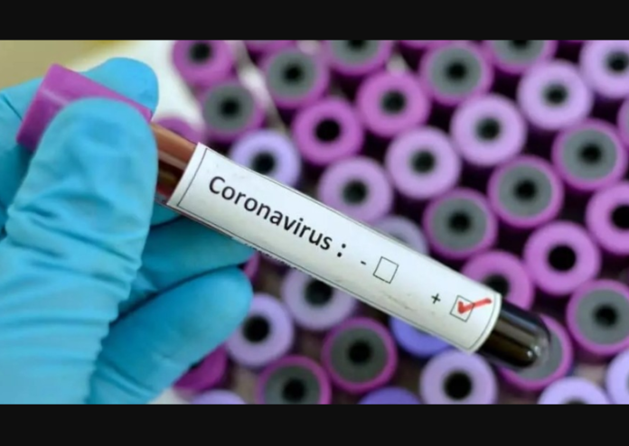 With Coronavirus Underway, Nigerian Doctors Go On Indefinite Strike 1 Coronavirus