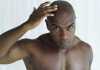 Lifestyle: Foods That Can Make You Go Bald