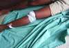 Father Cuts Off Leg Of Man Who Defiled His 6-Month-Old Baby In Edo