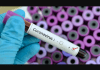 Africa Free Of Coronavirus As 1st Egyptian Case Tests Negative Coronavirus