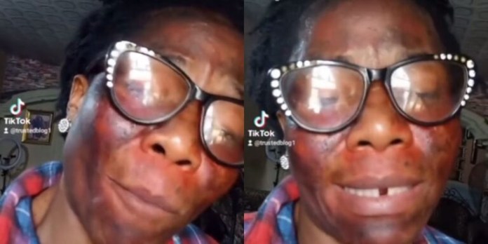 My Husband’s Side Chic Gave Me Acid As Organic Product For Face – Woman Alleges (Video)
